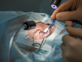 does lasik require anesthesia