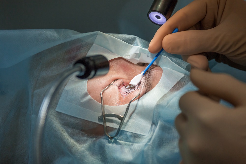 does lasik require anesthesia